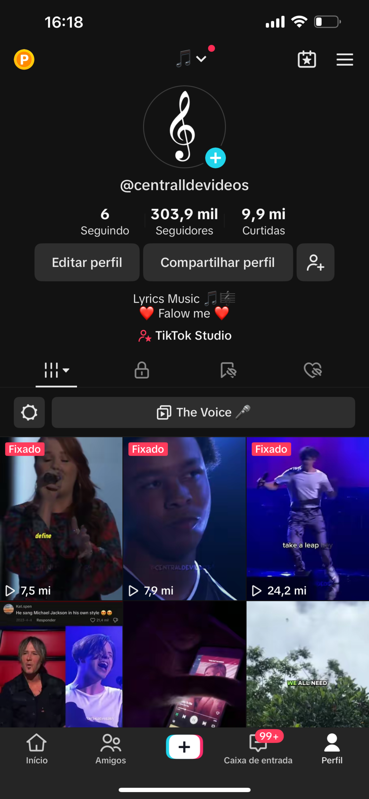 IMG_2899 Perfil de Música Tiktok +300k - Imagem 1